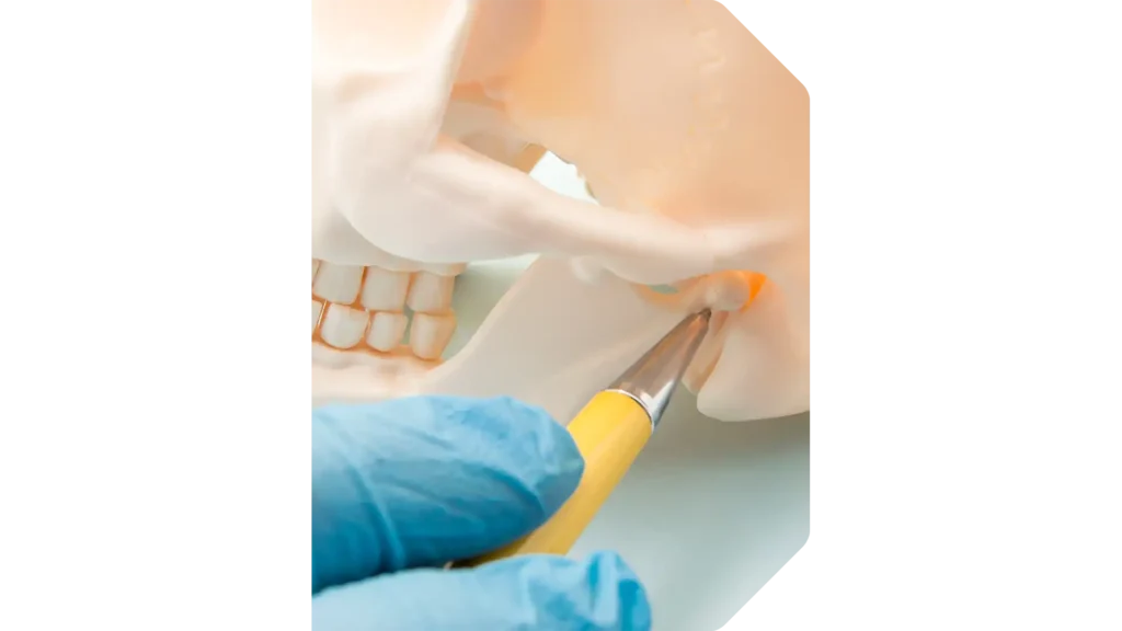 Gnatologia a Milano - Studio Dentistico Dentit