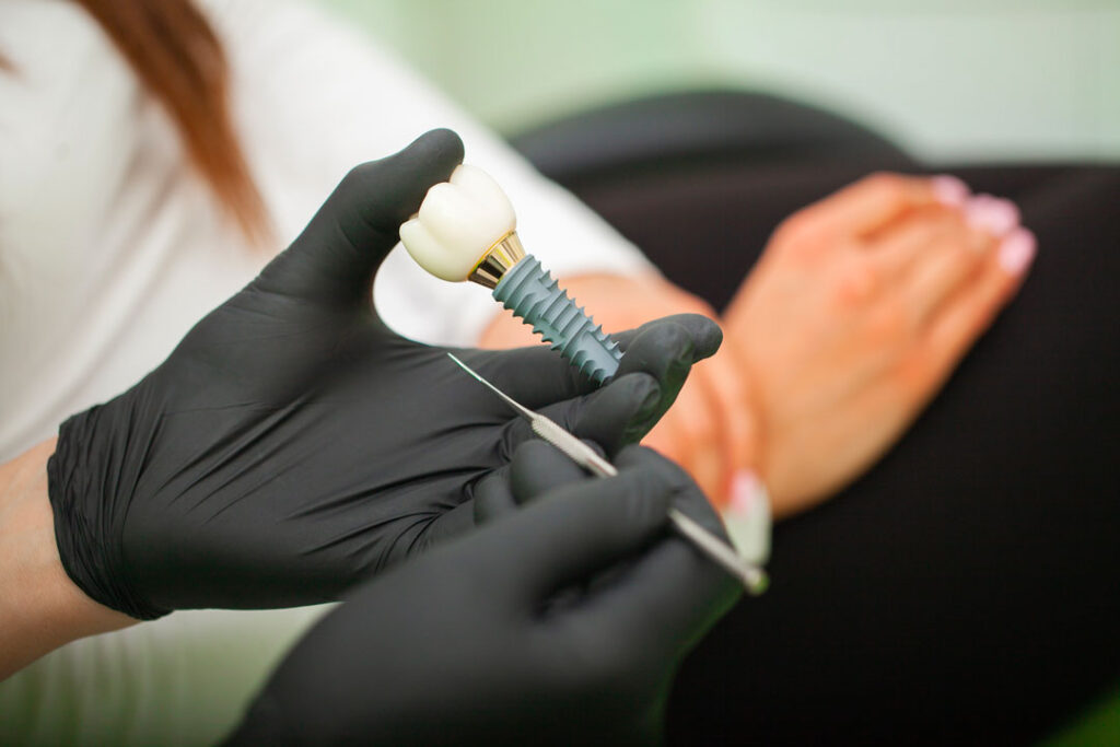 è doloroso l’impianto dentale